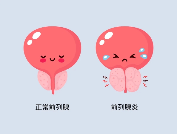 男性朋友经常做这5个动作，可以有效保护前列腺-前列腺论坛